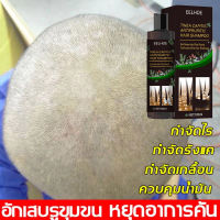 EELHOE แชมพูขจัดรังแค ล้างแล้วช่วยขจัดรังแค ยาสระผมเชื้อรา 500ml กำจัดเกื้อน ยาสระผมรังแค กำจัดไร กำจัดรังแค ควบคุมน้ำมัน แชมพูแก้ผมร่วง ยาสระผมแก้คัน