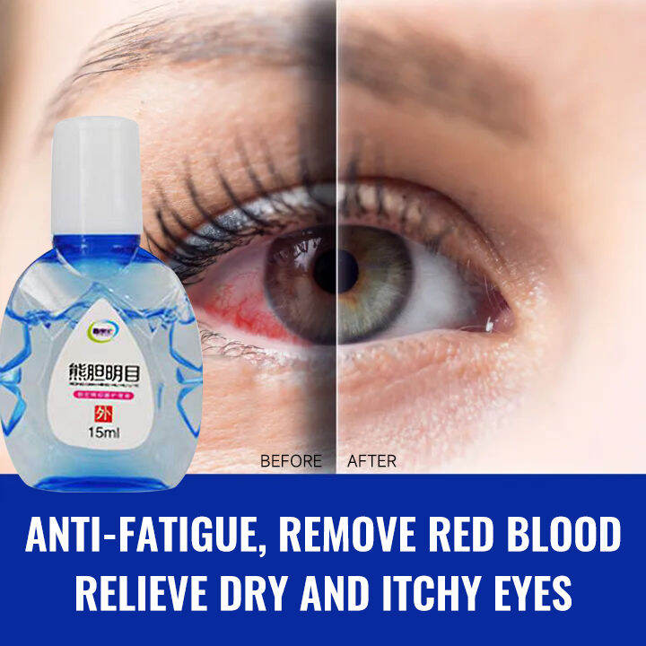 【Restore you vision】Eye Drops Dry Eye AntiFatigue Eye Congestion Blurred Eyes Redness Eyes