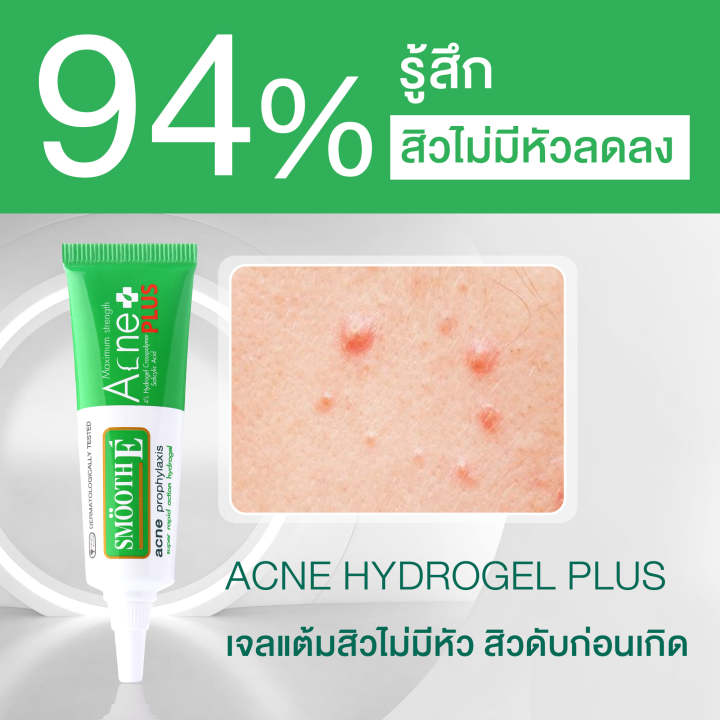 smooth-e-anti-acne-set-จบทุกปัญหาสิว-ผิวมัน-ลดสิว-ควบคุมความมันบนใบหน้า-สิวยุบทันใจภายใน-24-ชั่วโมง-อ่อนโยนต่อผิว-ผิวมัน-ผิวแพ้ง่าย-เป็นสิวง่าย