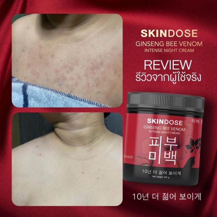 skindose-ginseng-bee-venom-intense-night-cream-โสมพิษผึ้งจักรพรรดิ-โลชั่นบำรุงผิวสูตรกลางคืน-เข้มข้น