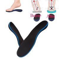 Orthotic Insoles for Flat Feet Strephexopodia XO Leg Arch Support Plantar Fasciitis Relieve Feet Heel Pain and Pronation Sports Shoes Accessories