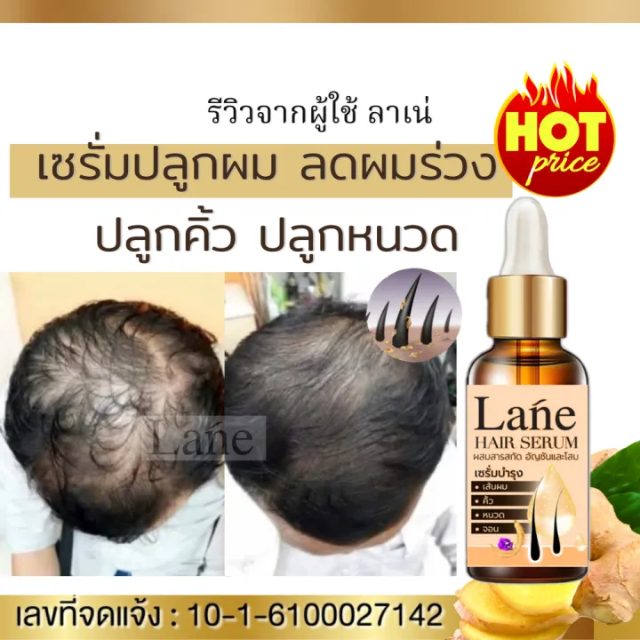 Lane เซรั่มปลูกผม ลูกผมดก ลดผมบาง ปลูกคิ้ว ผมร่วง หัวล้าน น้ำปลูกผม ยาปลูกผม เร่งผมยาว ยาปลูก