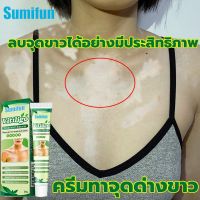 พร้อมส่ง โปรโมชั่น โรคปูนปลาสเตอร์ โรคด่างขาวด่างขาวด่างขาวที่แขนด่างขาวจากสะเก็ดเงิน หน้าเป็นด่างขาว จุดขาวโรคด่างขาว กระขาวผิวเป็นวงสีขาว ส่งทั่วประเทศ พรรณ ไม้ น้ำ พรรณ ไม้ ทุก ชนิด พรรณ ไม้ น้ำ สวยงาม พรรณ ไม้ มงคล