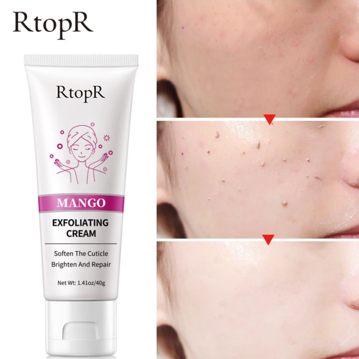 rtopr-mango-เจลผลัดเซลล์-เจลขัดผิว-ครีมสครับผิวมะม่วง-ฮิตใน-tiktok-rtopr-facial-exfoliating-cream-ครีมเจลขัดผิว-ครีมขัดผิว-เจลขัดผิวหน้า-ขจัดสิวหัวดำ