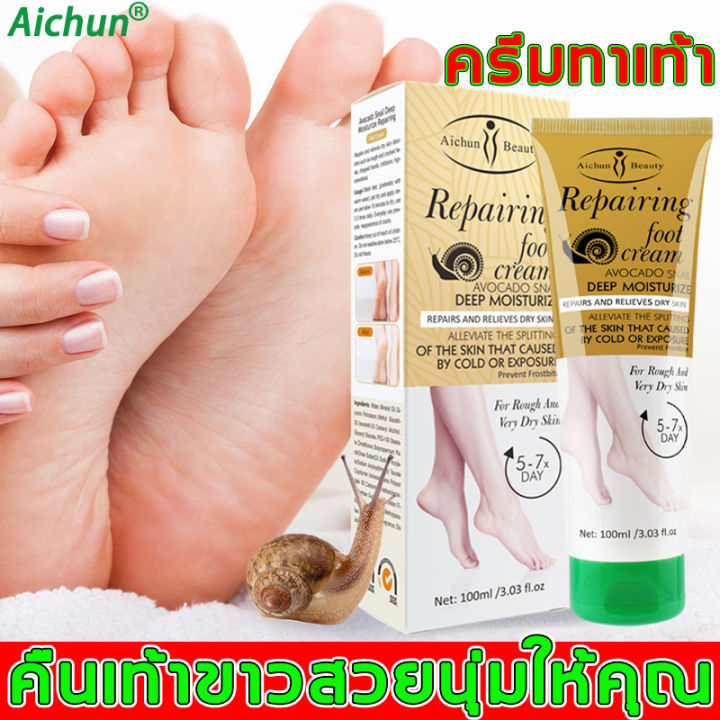 aichun-ครีมทาเท้าแตก-100ml-ครีมบำรุงเท้า-ป้องกันรอยแตกเท้า-ซ่อมแซมส้นเท้าแห้งแตก-แห้ง-หยาบ-หนังแข็ง-ครีมทาส้นทาแตก-ครีมทาส้นเท้าแตก-ส้นเท้าแตก-ครีมทาเท้าขาว-ยาทาส้นเท้าแตก-ครีมส้นเท้าแตก-foot-cacked-h