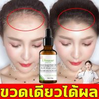 Disaar เซรั่มปลูกผม น้ำยาปลูกผม30ml ช่วยปรับปรุงผมร่วง เร่งการเจริญเติบโตของเส้นผม ยาปลูกผมของแท้ เซรั่มบำรุงผม ปลูกผม สำหรับผมบาง นีโอแฮร์ของแท้ สเปรย์ปลูกผม น้ำยาปลูกผมชาย ปลูกผมเร่งด่วน น้ำยาเร่งผมยาว น้ำยาใส่ผม