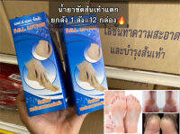 น้ำยาขัดส้นเท้า ขายยกลัง(บรรจุ12 กล่อง) F.G.L Lotion เอฟ.จี.แอล.โลชั่น?น้ำยาแช่เท้า ฟื้นฟูและทำความสะอาดผิวเท้า แก้ปัญหาส้นแตกกร้าน