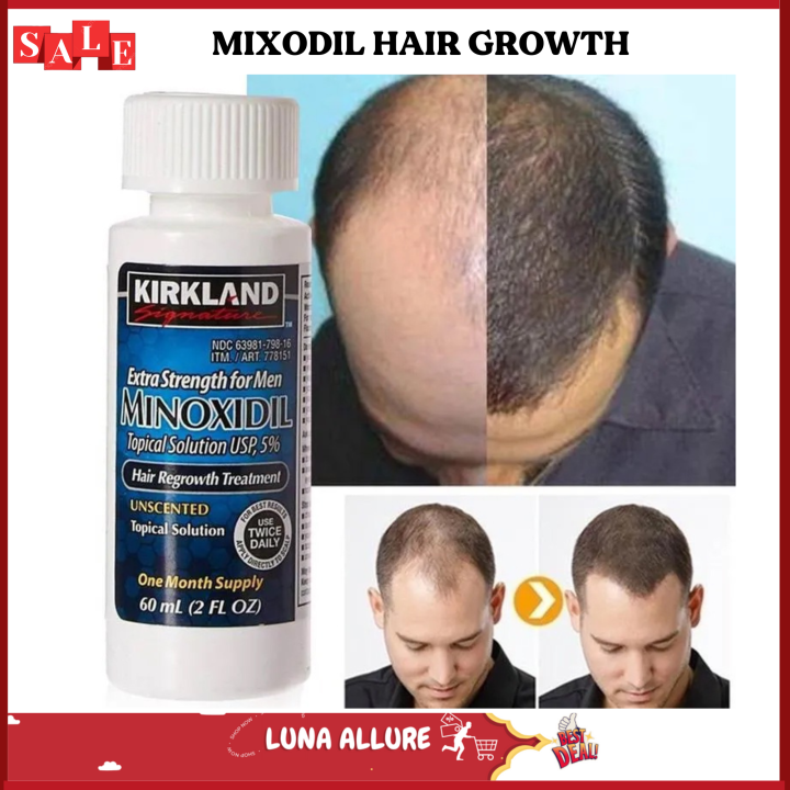 IN STOCK! Kirkland Minoxidil 5% Topical Solution Hair Grower for Men ...