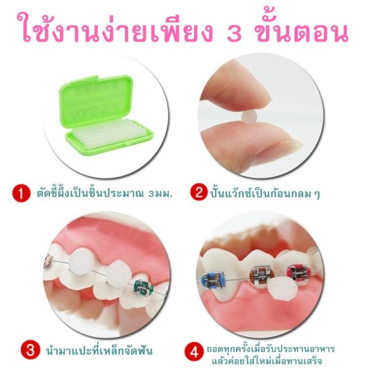 ขี้ผึ้งจัดฟัน-สำหรับคนจัดฟัน-1ตลับ-มีขี้ผึ้ง-5-แท่ง-สินค้าพร้อมส่ง-คละสี-คละกลิ่น-ใช้สำหรับติดบนเครื่องมือจัดฟัน