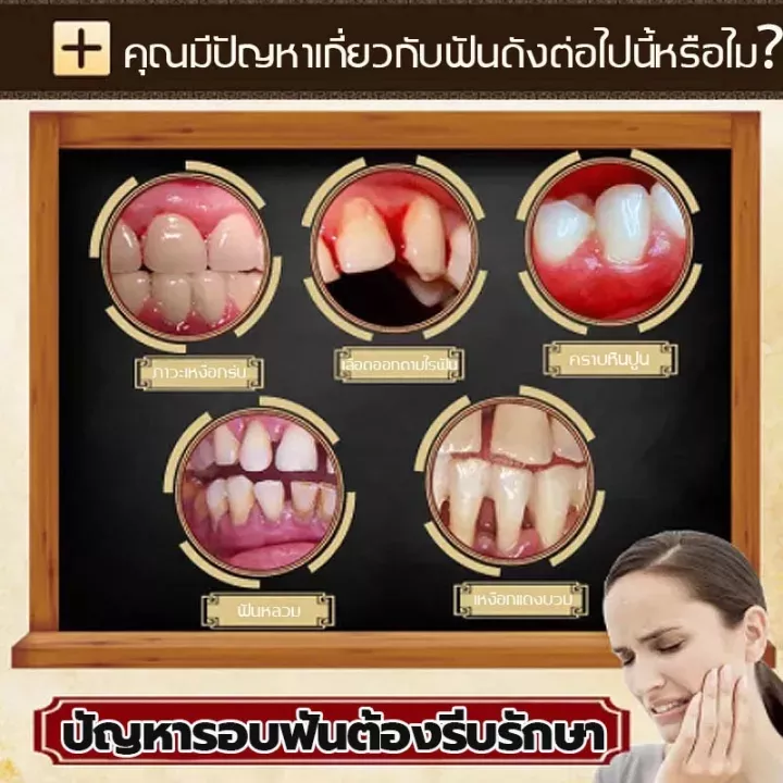 บอกลาอาการปวดฟัน-bee-venom-ยาสีฟัน110g-ดูแลสุขภาพช่องปากคุณ-ไม่ต้องเป็นห่วงเรื่องเหงือกบวม-ฟันผุและแผลในช่องปาก