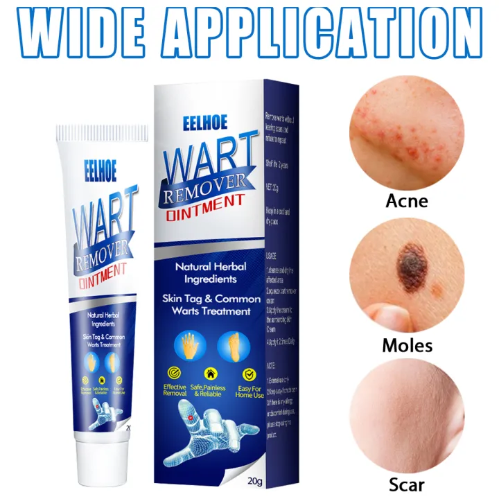 Có nên sử dụng Eelhoe Warts Remover Cream để loại bỏ nốt ruồi và các vết thâm trên da?
