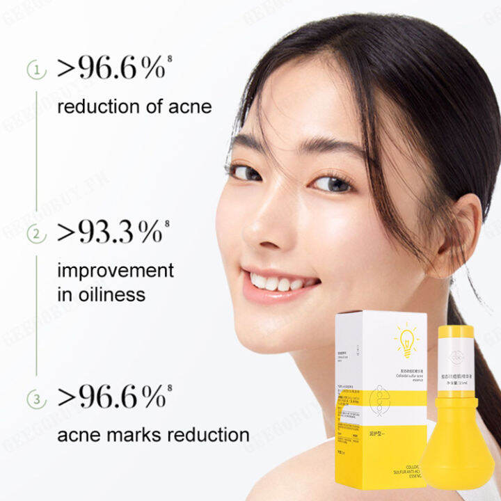 Ezey Acne & Scar Treatment Essence for Flawless Skin Lazada PH