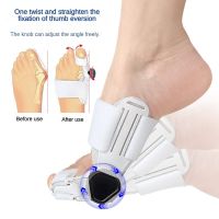 ♤℡ Bunion Straightener Toe Corrector Big Toe Eversion Splint Adjustable Hallux Valgus Corrector Foot Care Pain Relief Tools