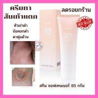 ส่งฟรี ครีมทาเท้าแตก ส้นเท้าแตก หัวเข่าด้าน ตาตุ่มดำ ข้อศอกด้าน ช่วยให้ผิว ชุ่มชื่น กิฟฟารีน สกิน ซอฟเทนเนอร์ โลชั่นทาเท้า Giffarine Skin Soften