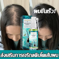 ?บอกลาหัวล้าน? สเปรย์ปลูกผม เร่งผมขึ้นใหม่ เร่งผมยาวไว ป้องกันผมร่วง ป้องกันผมร่วงอย่างมืออาชีพ แก้ปัญหาผมร่วง ลดผมร่วง(น้ำยาใส่ผม ยาปลูกผม น้ำยาปลูกผม น้ำยาเร่งผมยาว เซรั่มปลูกผม ปลูกผมเร่งด่วน ปลูกผม ยาปลูกผมของแท้ ยาปลูกผมผู้ชาย)Hair Growth