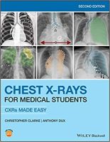 Chest X-Rays for Medical Students : CXRs Made Easy, 2ed - ISBN 9781119504153 - Meditext