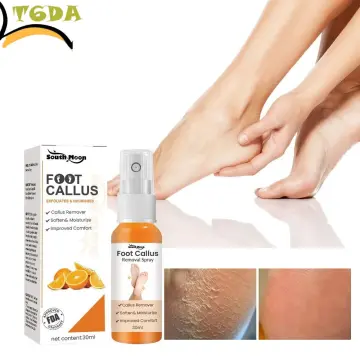 The Best Callus Remover of 2024