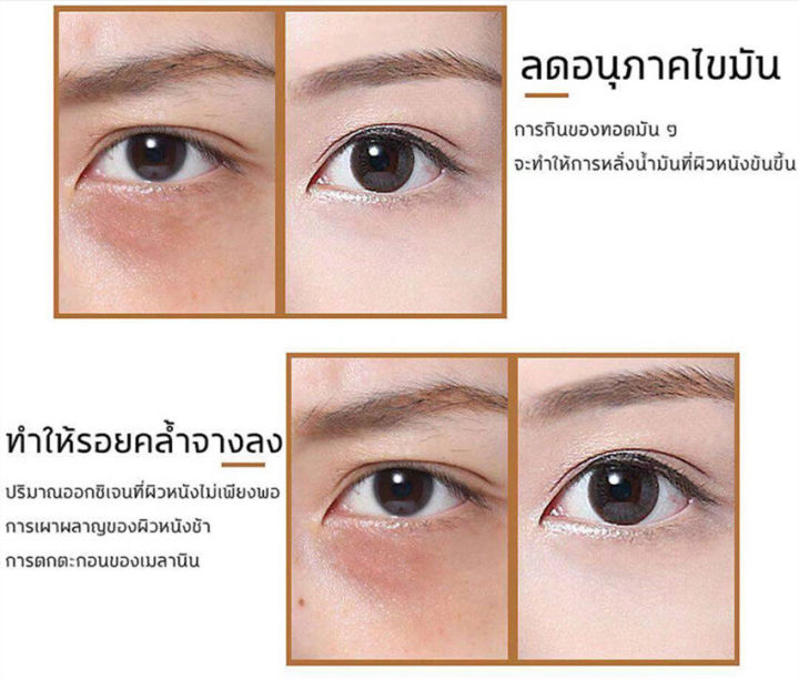 bingju-ครีมบำรุงรอบดวงตา-30ml-ครีมบำรุงใต้ตา-อายครีม-ครีมทาใต้ตาดำ-ต่อต้านริ้วรอย-ปรับปรุงตาดำถุงใต้ตาและปัญหารอบดวงตาอื่น-ครีมบำรุงรอบตา-ชับผิวใต้ตาอทำให้ริ้วรอยจางลง-ครีมทารอบดวงตา-ลดใต้ตาดำ-ครีมลบถ