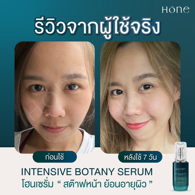 ของแท้-ส่งฟรี-เซรั่มหนุ่มกรรชัย-2ขวด-2เดือน-โฮนเซรั่ม-hone-intensive-botany-serum-ไฮยาฟิลเลอร์-โบท็อกซ์-ยกกระชับผิว-เซรั่มผิวหน้า-ลดร่องแก้ม