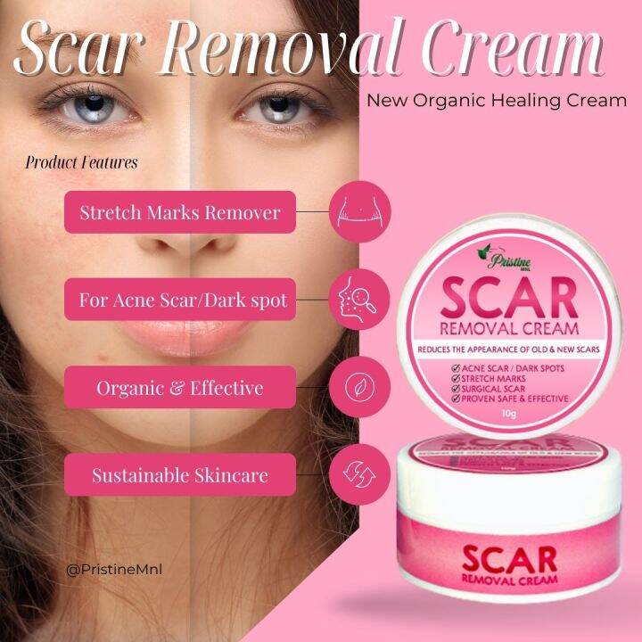 10mg Scar Removal Cream Scar Cream Scar Repair Stretch Marks
