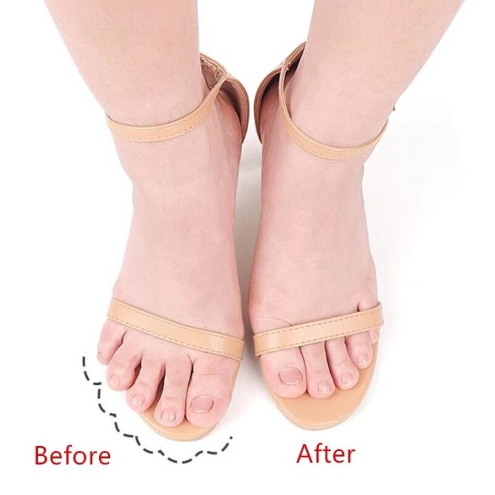 1-pair-anti-slip-self-adhesive-forefoot-pad-women-high-heel-protection-foot-insert-breathable-pain-relief-shoes-cushion