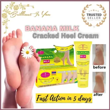 Banana Repair Foot Cream, Anti-cracking Dry Feet Balm, 30g Cracked Heel  Moisturizer, Foot Repair Moisturizing Remove Dead Skin, Foot Care Products  F