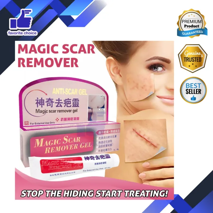 Stretch Marks Remove Acne Scar Treatment Cream Face Whitening Cream Pimple  (M1)(1U86)