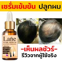 ?สินค้าขายดี?  เซรั่มปลูกผม น้ำยาปลูกผม  ปลูกคิ้ว ปลูกหนวด โลชั่นปลูกผม  ปลูกไรผม หัวเถิกปลูกผม  ขนาด 10 มล. (X1 ขวด)