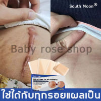 South Moon แผ่นแปะแผลเป็น ครีมทาแผลเป็น รักษาแผลเป็น ตัดตามต้องการ สามารถปรับปรุงรอยแตกลาย ลดรอยแผลเป็นนูนทั้งเก่าใหม่ รอยไหม้และแผลผ่าตัด(แผ่นแปะซิลิโคน,แผ่นแปะคีลอยด์,ซิลิโคนยากำจัดแผลเป็น,แผ่นแปะซิลิโคนเจล,แผ่นแปะรอยแผลเป็นนูน,ครีมลบรอยแผลเป็น)