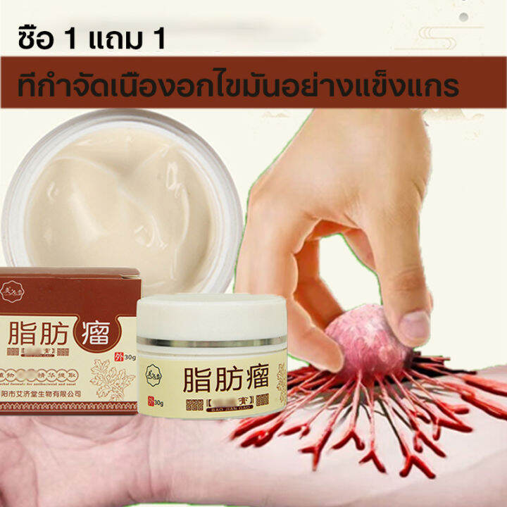 รายการ 97+ ภาพพื้นหลัง การผ่าตัดเนื้องอกไขมันออกจากผิวหนัง อัปเดต