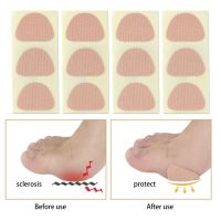 12Pcs Foot Corns Killer Analgesic Sticker Foot Warts Removal Calluses Plantar Protection Thorn Pain Relief Medical Plaster