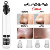 Olivision เครื่องดูดสิว ดูดสิวเสี้ยนอุดตัน เครื่องกำจัดสิว เครื่องดูดสิวไมโครคริสตัล ที่ดูดสิว เครื่องดูดสิวหัวดำ ที่ดูดสิวไฟฟ้าดูดสิวหัวดำ เครื่องมือในการกำจัดสิวหัวดำ ทำความสะอาดสิวหัวดำ สิวเสี้ยน เปลี่ยนหัวดูดได้ถึง 4 แบบ electric blackhead remover