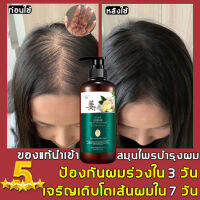 ชุด4ชิ้นสุดคุ้ม แชมพู500ml ทรีทเมนต์500g เซรั่ม30ml รักษาผมร่วง ป้องกันผมร่วง บำรุงผม รากผม ลดผมมัน ปลูกผม เร่งผมยาว ผมสวย เงางาม