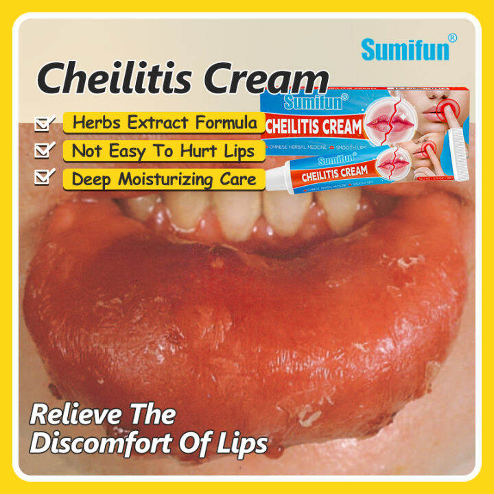 Heal and Repair Inflamed Lips SUMIFUN 20G Cheilitis Lip Care Cream Lip