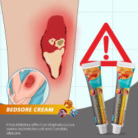 Repair Pressure Ulcers Cream Rotten Leg Bedsore Wound Care Cream Healing of Bed Sores Pressure Sores Ulcers