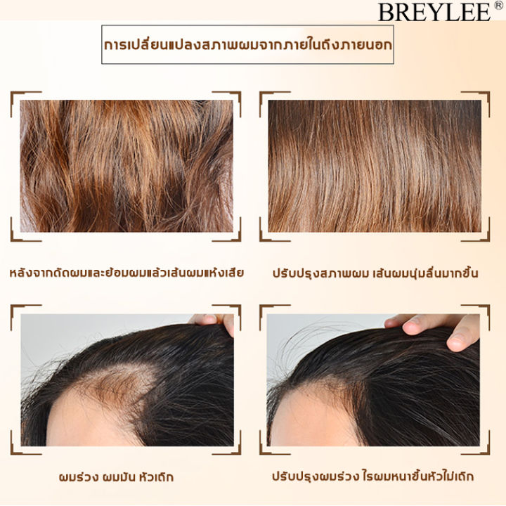 breylee-เซรั่มปลูกผม-ปัญหาผมร่วง-ทาผมร่วง-ผมร่วง-ผมแห้ง-เซรั่มปลูกผม-ที่ปลูกผมของแท้-ปลูกผม-ให้ผมยาว-ปลูกผม-เซรั่มปลูกผม-เซรั่มทาผม-เส้นผมปลูกผม-เซรั่มทาผม-ทาผมร่วง-หัวล้าน-หัวเถิกhair-growth-essentia