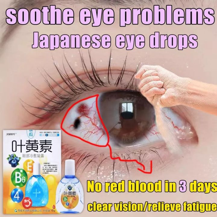 Lutein Eye Drops Relieve Ophthalmic Liquid Itchy Eye Swelling Sore Pain Blurred Vision