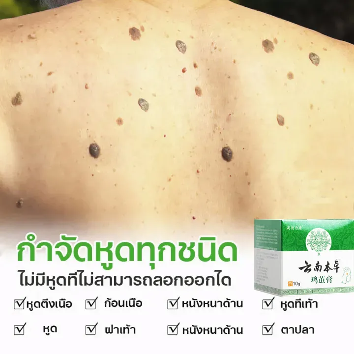 ขี้แมลงวัน-หูดตาปลาและติ่งเนื้อ-ของแท้-corns-warts-removal-พร้อมส่ง-ไฝ-ครีมแต้มหูด-ลอกหูดตาปลา-ปลอดภัยไม่เจ็บ