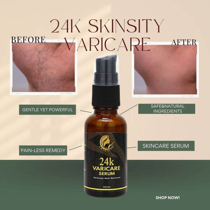 Original Skinsity 24k Varicose Vein Remover Varicare Serum Remover 30ml ...