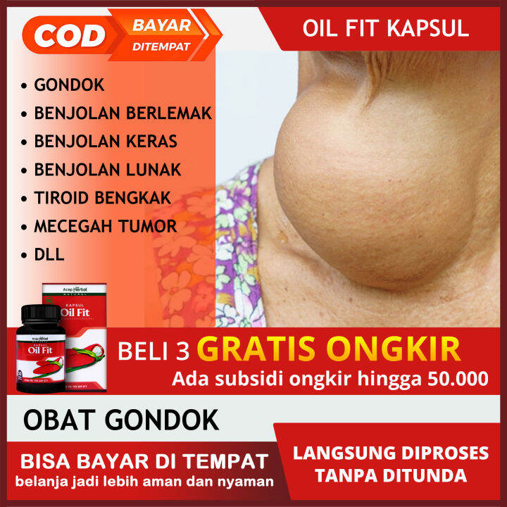 Oil Fit Kapsul Solusi Tepat Untuk Obat Gondongan Gondok Pipi Bengkak