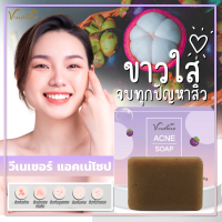 สบู่สิว ลดสิว ฝ้า หน้าใส สารสกัดมังคุด ลดหน้ามัน ต้านสิวใหม่ รอยสิวเดิมจางลง V-Nature Acne Soap สบู่สูตรพิเศษ ลดสิวเสี้ยน ลดรอยสิว {วีเนเชอร์}