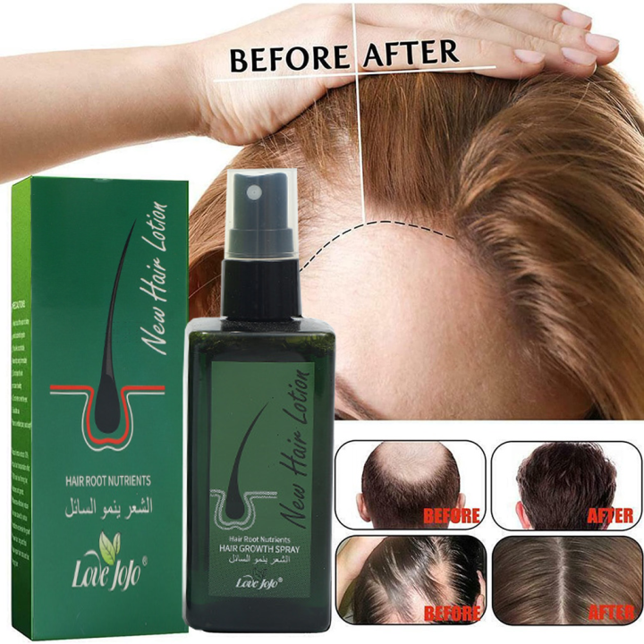 Hair growth spray Hair tonic Serum Loss Treatment Anti Hair Loss Hair
