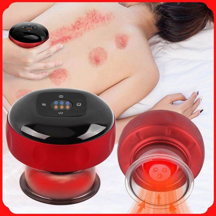 PHL Electric Dynamic Cupping Therapy Set 3 in 1 Smart Ventosa Vacuum ...