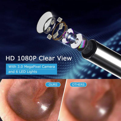 Smart HD Visual Ear Picker พร้อมกล้องสำหรับ S และเด็กที่มี Light-Up Ear Picking Tool