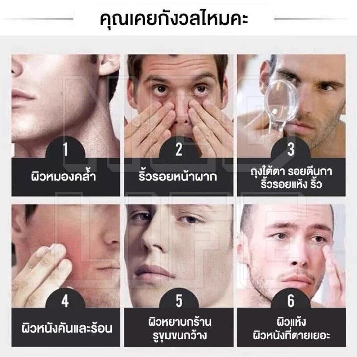 feichunครีมต่อต้านริ้วรอย-เปปไทด์-ครีมทาหน้า-ต่อต้านริ้วรอย-aliver-ครีมกลางคืนและกลางวัน-ลดเลือนริ้วรอย-จุดด่างดำ-บำรุงผิวหน้า-กระชับผิว-ซ