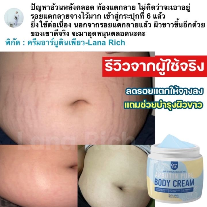 อาร์บูตินเพียว-arbutin-pure-ลาน่าริช-เร่งขาว-ครีมทาผิวตัว-ผสมอาร์บูติน-และ-กลูต้า-ลดรอยแตกลาย