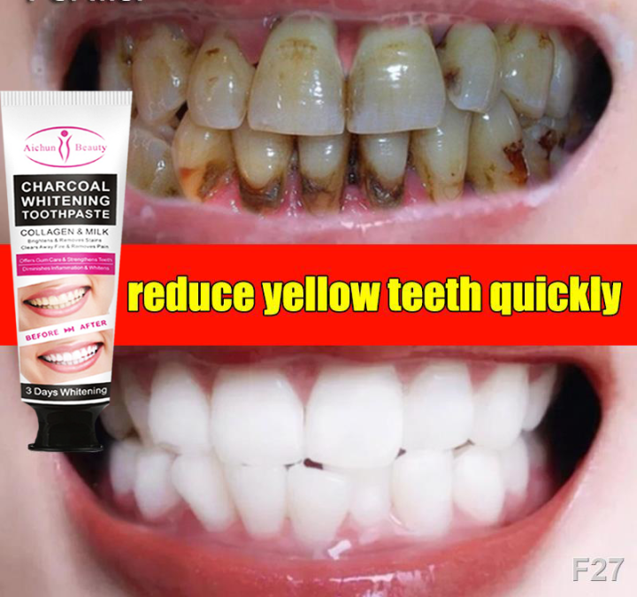 Aichun Beauty Charcoal Whitening Toothpaste 100ml Deep Clean Best Natural Whitener, Vegan