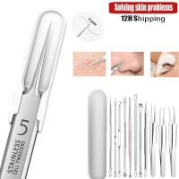 Pimples Tweezers Blackhead Remove Tool Skin Care Facial Acne Removal Kit Black dots Cleaner Professional Pimples Kit Beauty Heal