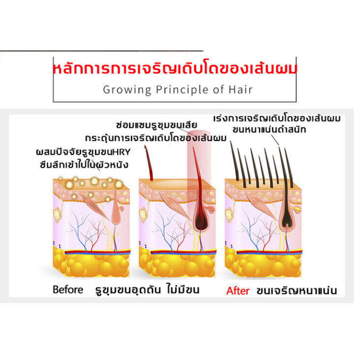 เซรั่มปลูกผม-30g-น้ำยาปลูกหนวด-เร่งเครา-จอน-คิ้ว-ปลูกคิ้ว-น้ำยาบำรุงหนวด-ปลูกหนวด-น้ำยาปลูกคิ้ว-เซรั่มปลูกคิ้ว-ปลูกเครา-น้ำยาปลูกผม-เซรั่มปลูกผมดก-ปลูกคิ้วดกดำ-ปลูกหนวดของแท้-น้ำยาเร่งหนวด-นํ้ายาปลูกค