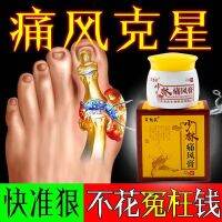 Gout Ointment Stone Crystal Cervical Spine Big Toe Swelling Finger Joint Pain Nemesis And Relief